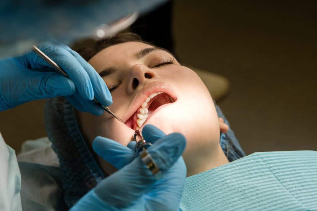 Wisdom Teeth Removal in Denton